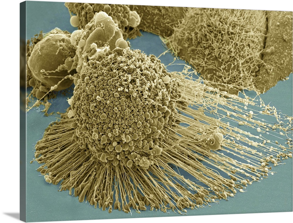 Scanning electron micrograph of an apoptotic HeLa cell. Zeiss Merlin HR-SEM.